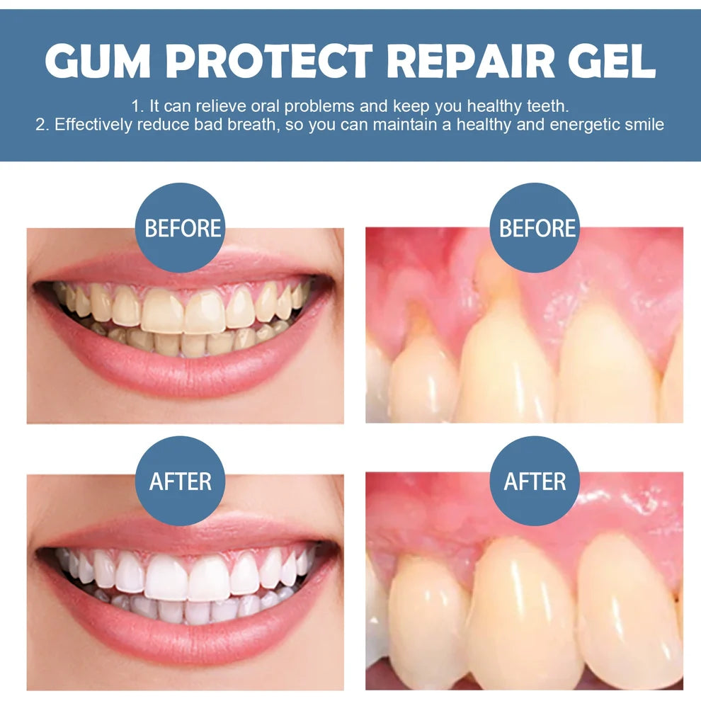 Gum Protect Dental Repair Gel🦷