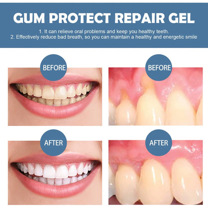 Gum Protect Dental Repair Gel🦷